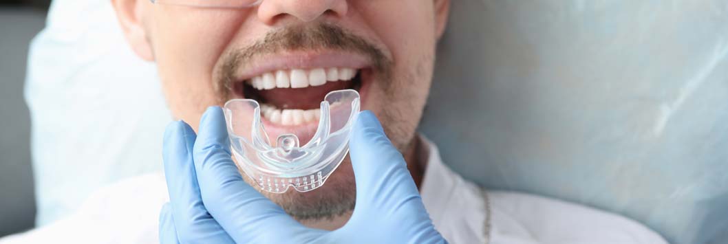 Oral Appliance for TMJ In Mouth To Sleep