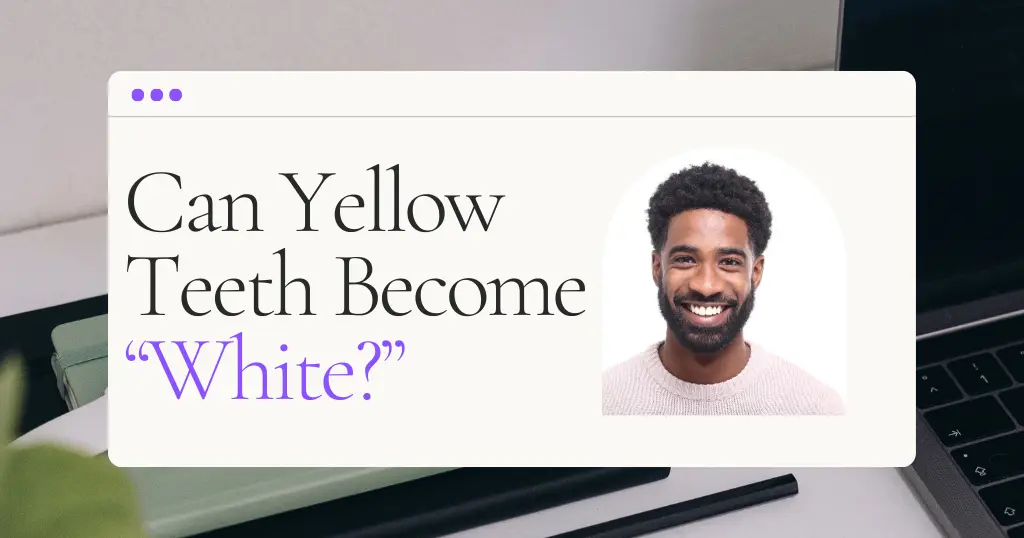 Yellow Blog Header