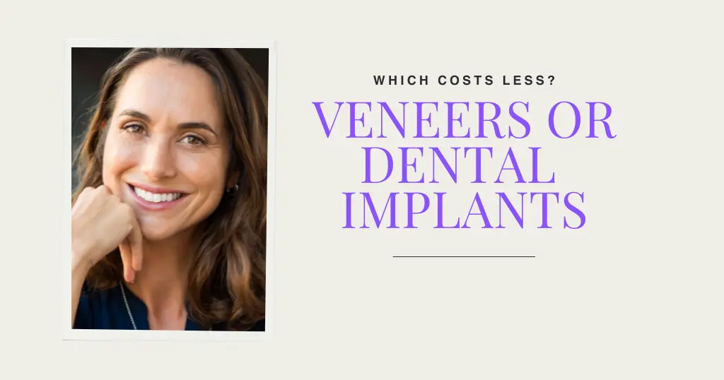 Veneers Blog Header